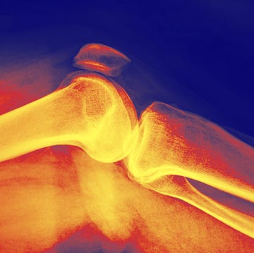 x ray image infrared effect of a knee joint with thigh and shin bone