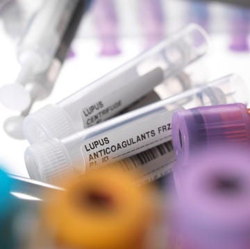 lupus anticoagulants
